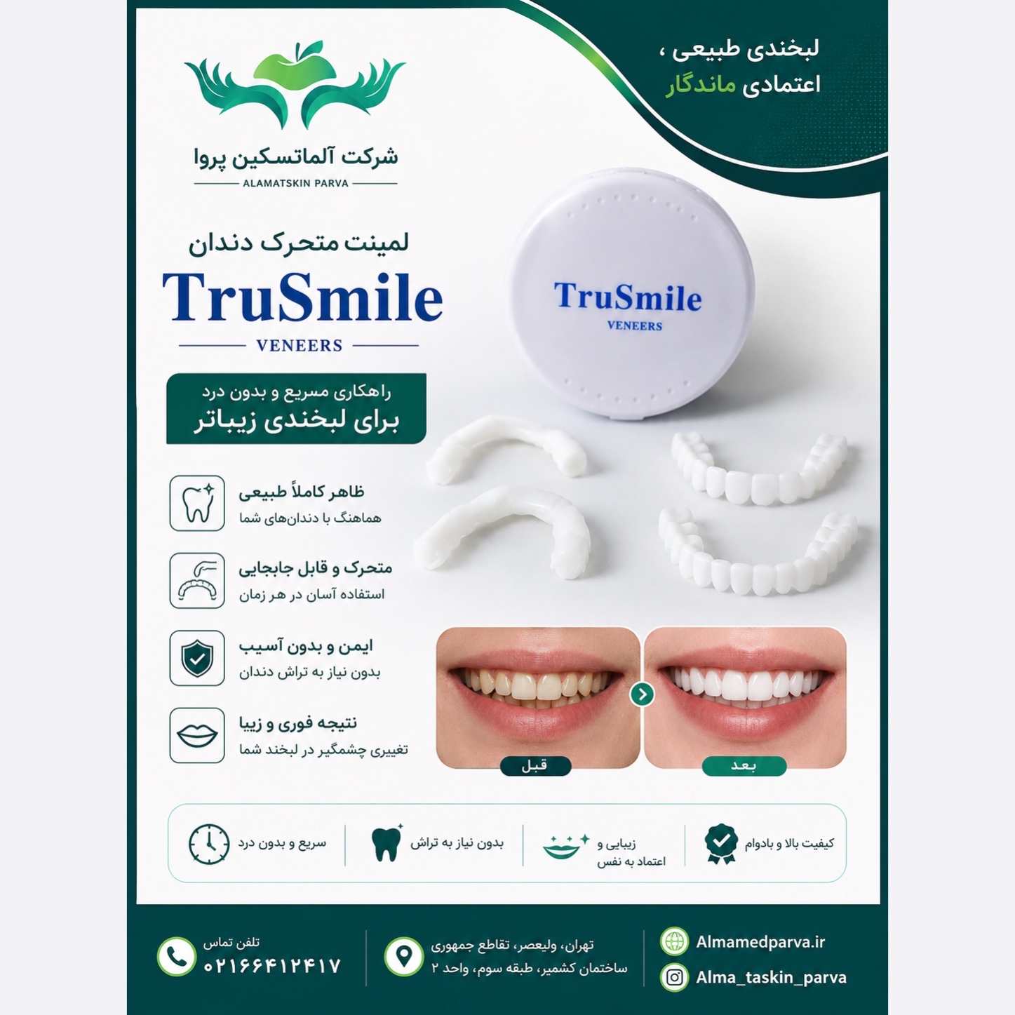 لمینت متحرک دندان ترو اسمایل عمده 15 عددی
